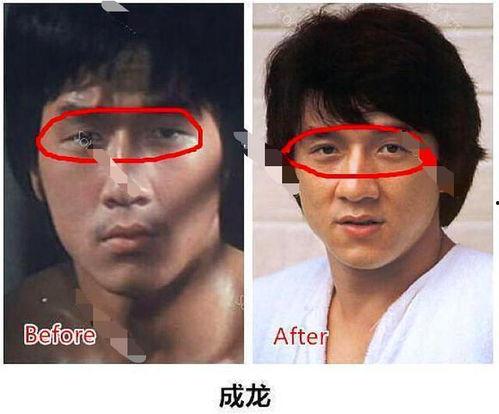 成龙爆料双眼皮视频,揭秘明星整形背后的真相  第3张
